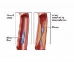 USA Vascular Centers - 2