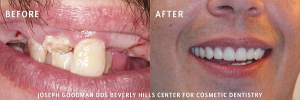 Dr. Joseph Goodman | Beverly Hills Dentist