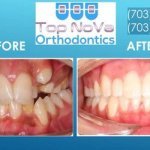 Top Nova Orthodontics - 1
