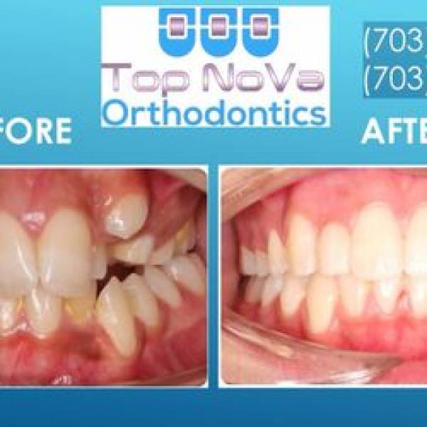 Top Nova Orthodontics