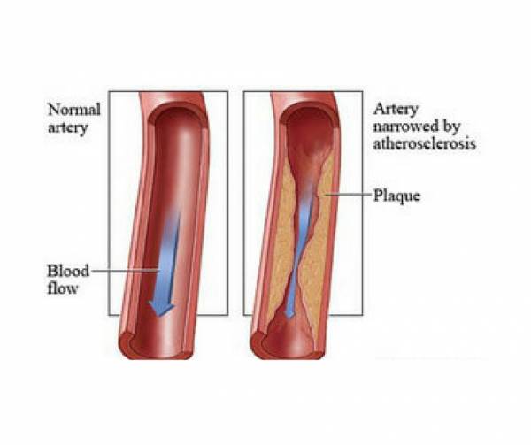 USA Vascular Centers